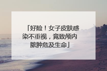 好险！女子皮肤感染不重视，竟致颅内脓肿危及生命